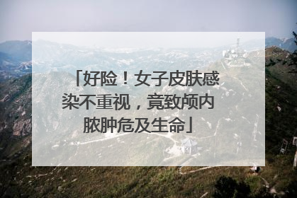 好险！女子皮肤感染不重视，竟致颅内脓肿危及生命